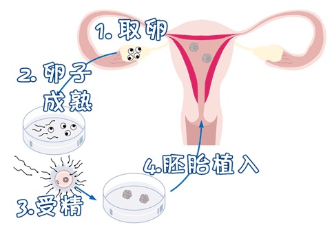 专业孕妈供卵助孕包生儿子
